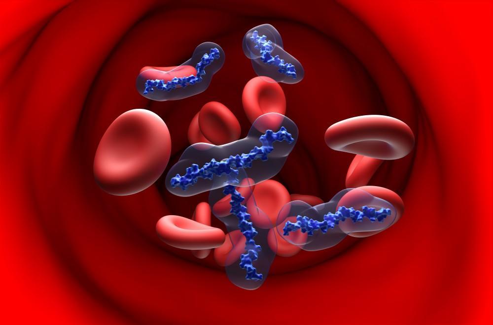 Should Patients With AFib Take Blood Thinners?
